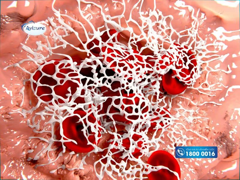 Những người bị rối loạn đông máu không nên uống Omega 3-6-9